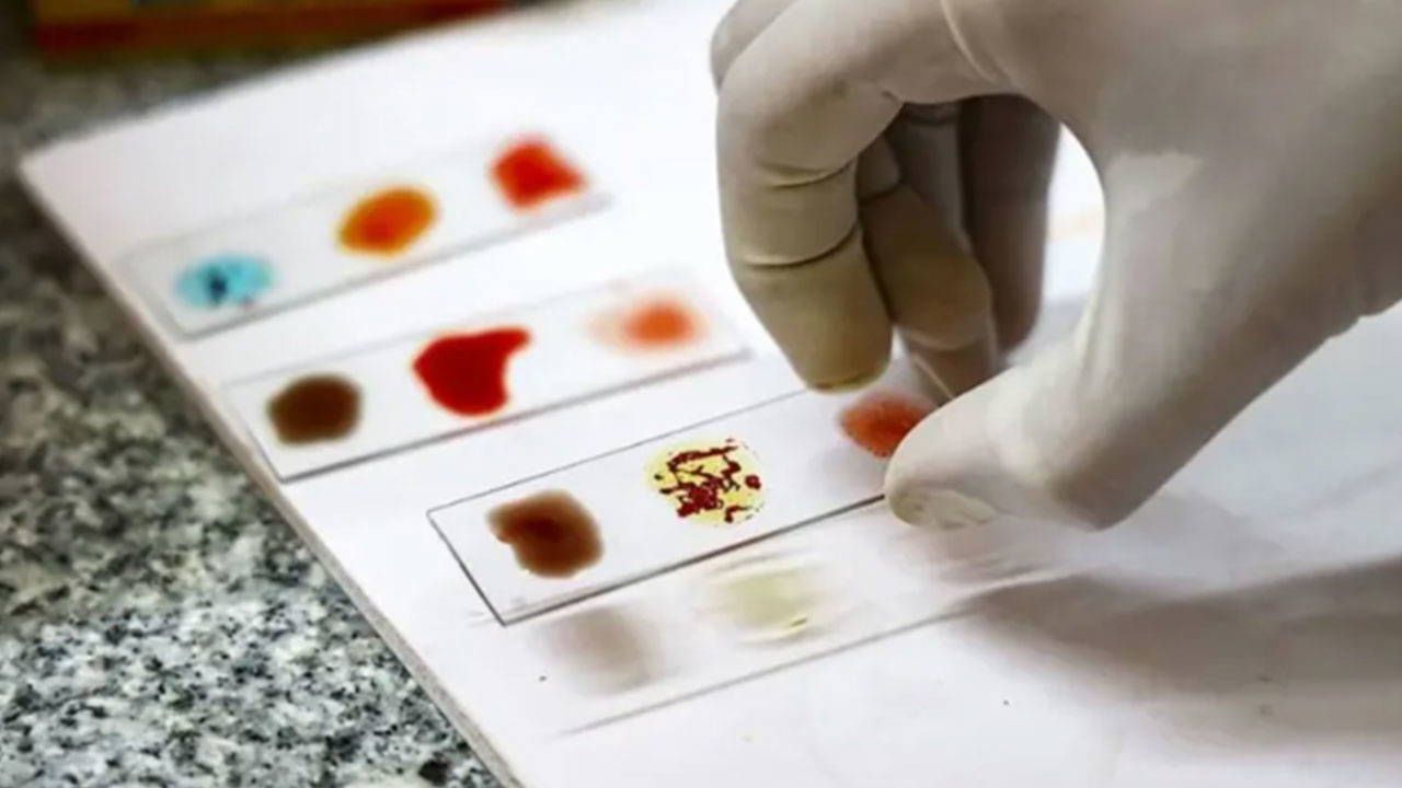  Altın Kan: Rh null Kan Grubunu Laboratuvarda Üretme Umudu