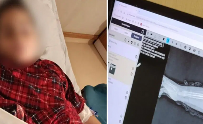 Okulda Kırılan Kol, Savcılıktan Çıkan 'Kovuşturmaya Yer Yoktur' Kararı: Akran Zorbalığı Vaka Raporu