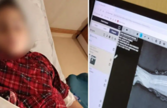 Okulda Kırılan Kol, Savcılıktan Çıkan 'Kovuşturmaya Yer Yoktur' Kararı: Akran Zorbalığı Vaka Raporu