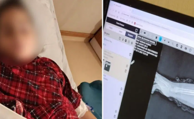 Okulda Kırılan Kol, Savcılıktan Çıkan 'Kovuşturmaya Yer Yoktur' Kararı: Akran Zorbalığı Vaka Raporu